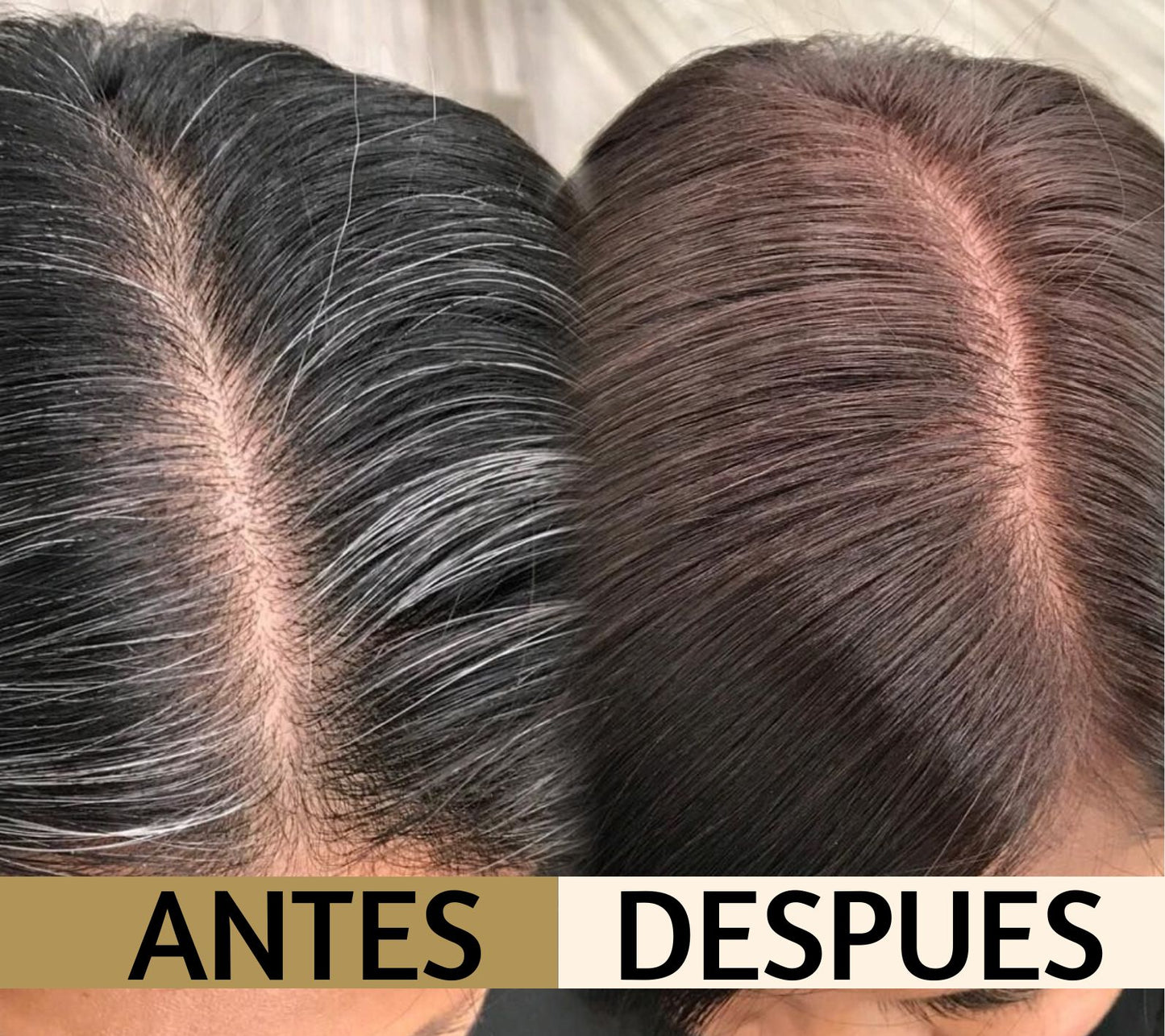 Shampoo + Tratamiento Chao Canas | Recupera tu color natural, cuida tu salud y ahorra dinero en un solo paso